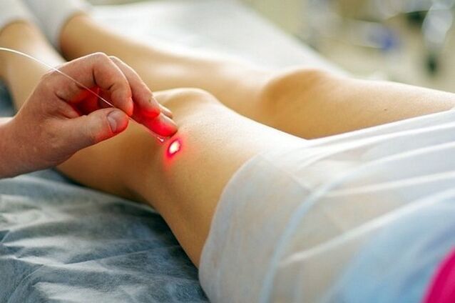 Papilomy lze léčit klinicky, například jejich odstraněním laserem